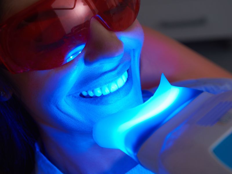 Teeth Whitening